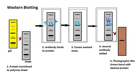 elisa test western blot difference|hiv confirmatory test western blot.